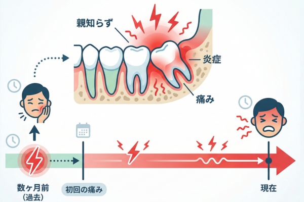 数ヶ月前から親知らずの痛みは始まっていたイメージ図解画像